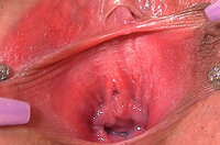 Free Login Gape My Pussy s0
